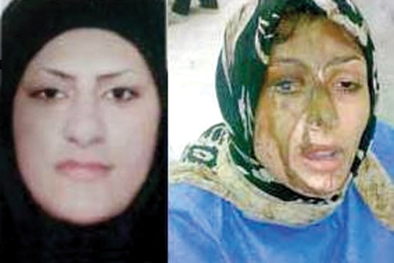 حبس، مجازات اسیدپاشی روی 2 خواهر
