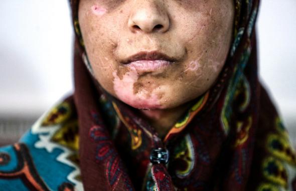 تصاویر : ۲۱روز شکنجه زجرآور برای زن بی پناه