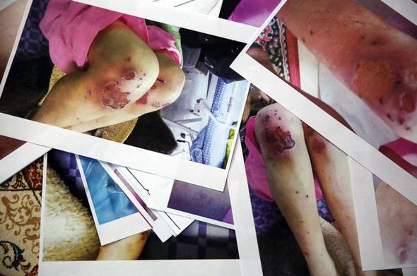 تصاویر : ۲۱روز شکنجه زجرآور برای زن بی پناه