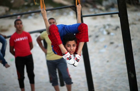 تصاویر : کودک عنکبوتی غزه