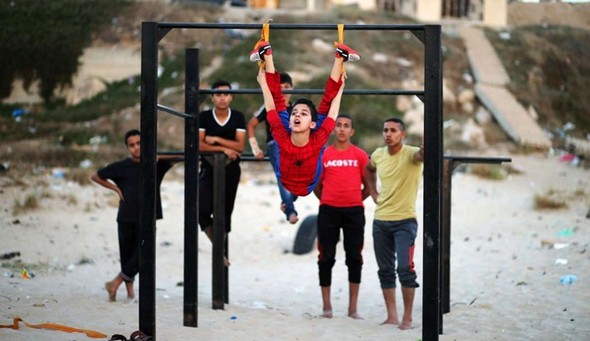 تصاویر : کودک عنکبوتی غزه