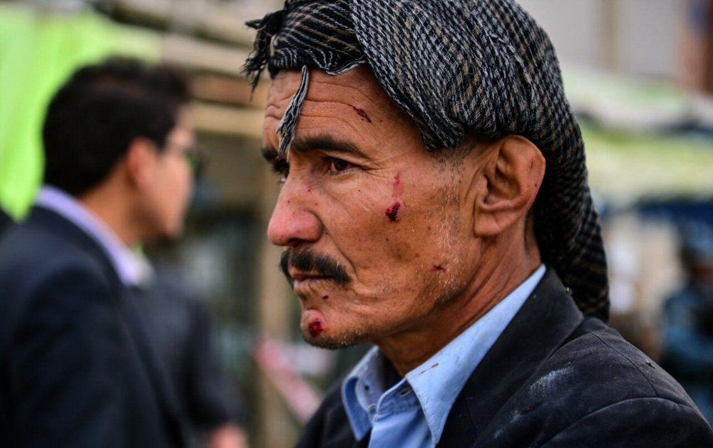 تصاویر : انفجار انتحاری در کابل