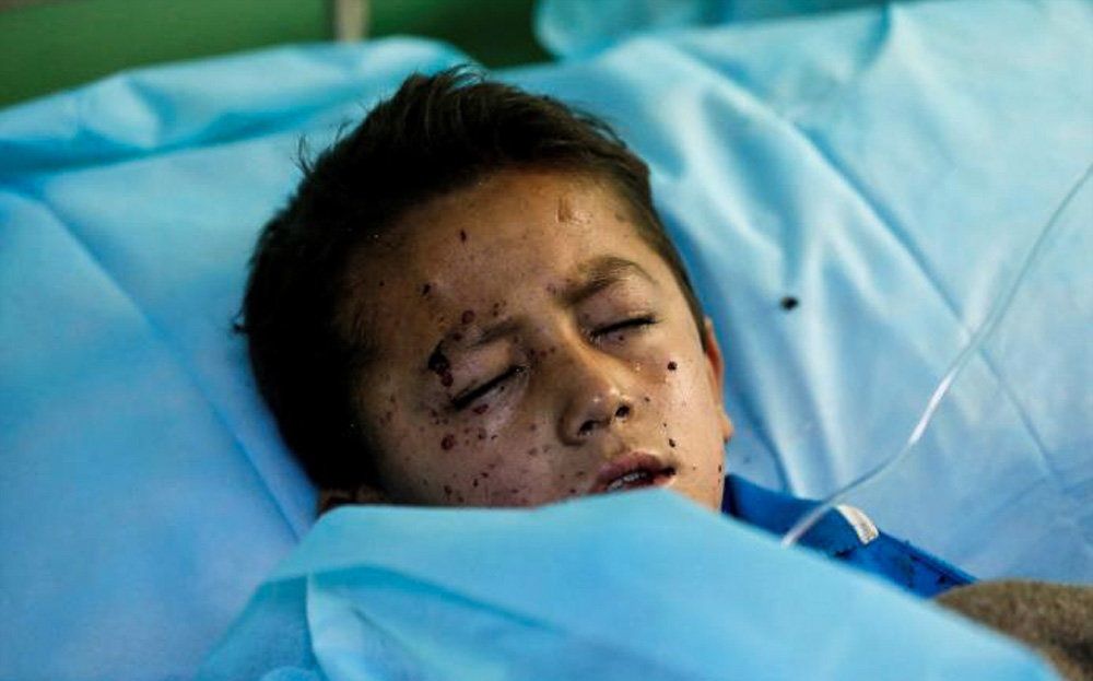 تصاویر : انفجار انتحاری در کابل