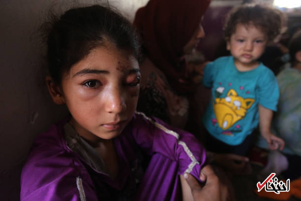 تصاویر : زخم جنگ بر سر و صورت کودکان تلعفر