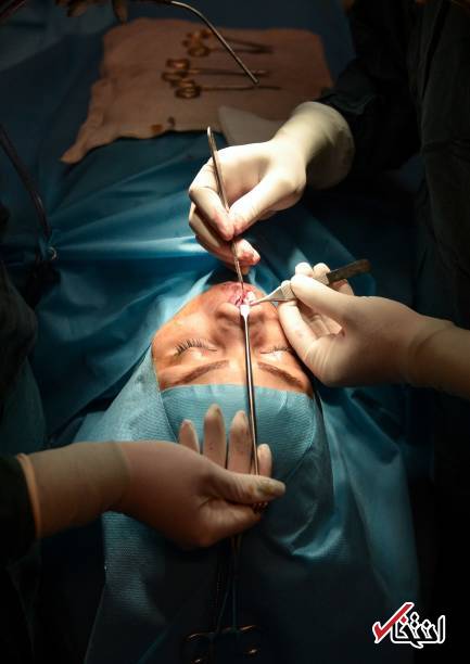 تصاویر : گزارش یک رسانه ترکیه‌ای از جراحی زیبایی بینی زنان در ایران