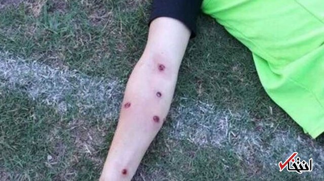 پلیس آرژانتین بازیکنان فوتبال را به گلوله بست +تصاویر پلیس آرژانتین بازیکنان فوتبال را به گلوله بست +تصاویر