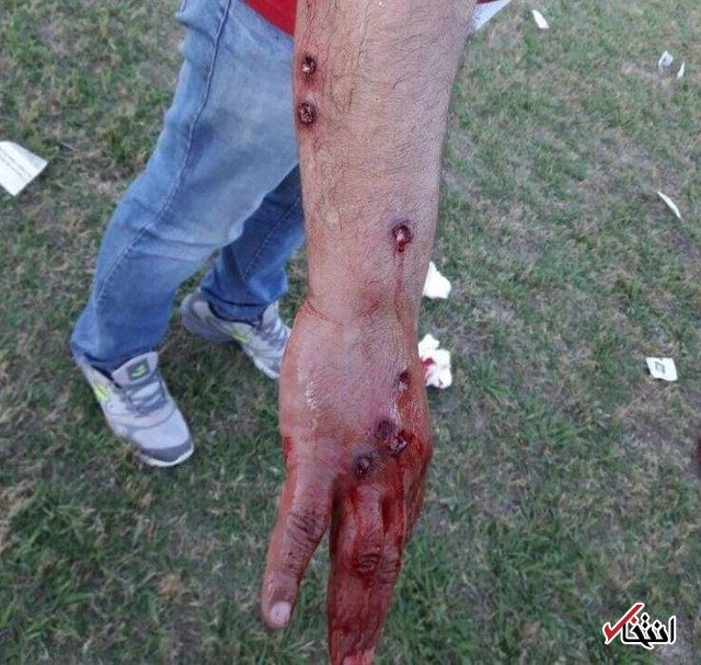 پلیس آرژانتین بازیکنان فوتبال را به گلوله بست +تصاویر پلیس آرژانتین بازیکنان فوتبال را به گلوله بست +تصاویر