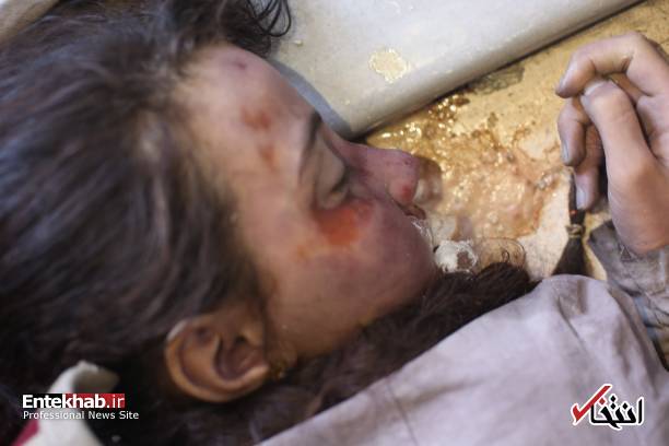 تصاویر دلخراش : کودکان قربانی اصلی حمله شیمیایی به دوما در غوطه شرقی دمشق