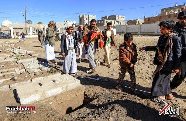 عکس/ دوقلوهای به هم چسبیده یمنی جان باختند