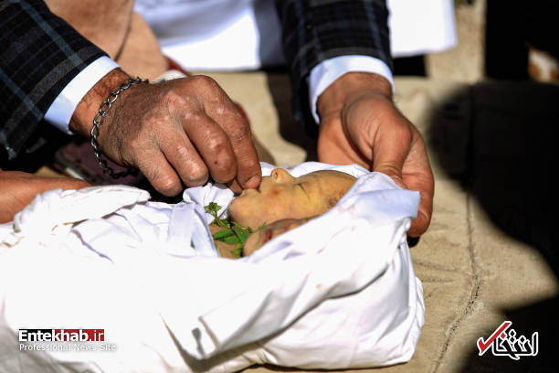 عکس/ دوقلوهای به هم چسبیده یمنی جان باختند