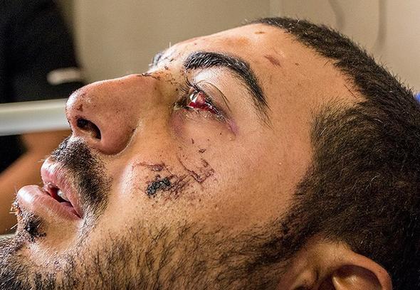 تصاویر : عیادت امیرپوردستان از سربازان مجروح