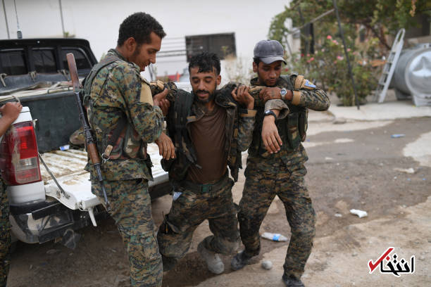 عکس/ لبخند نیروی کُرد سوری پس از زخمی شدن
