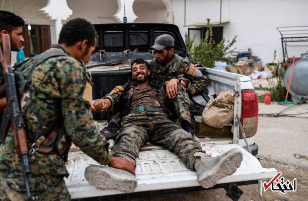 عکس/ لبخند نیروی کُرد سوری پس از زخمی شدن