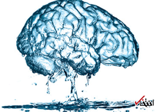 چرا وقتی سردرد می گیریم می گویند یک لیوان آب بخور؟! چرا وقتی سردرد می گیریم می گویند یک لیوان آب بخور؟!