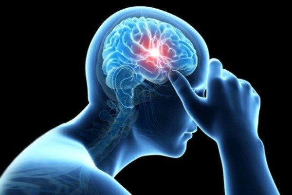 علایم سکته مغزی چیست؟/ پنج نشانه خطرناک