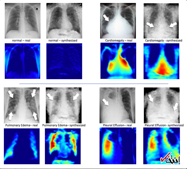 سیستم های آموزش هوش مصنوعی  با شبیه سازی اشعه ایکس  تولید شد / بهبود سرعت و افزایش دقت تشخیص پزشکی