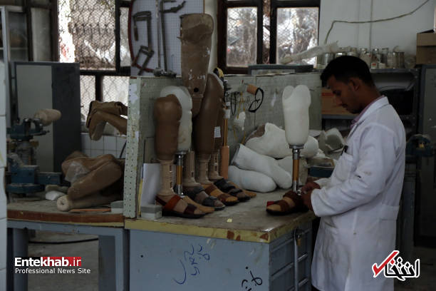عکس/ راه رفتن کودکان یمنی با پای مصنوعی