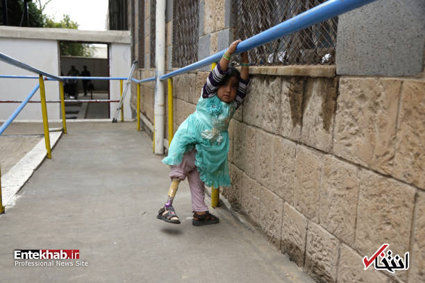 عکس/ راه رفتن کودکان یمنی با پای مصنوعی