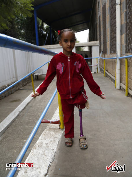 عکس/ راه رفتن کودکان یمنی با پای مصنوعی