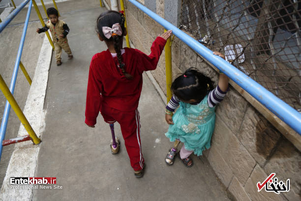 عکس/ راه رفتن کودکان یمنی با پای مصنوعی