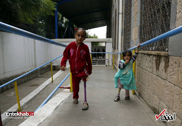 عکس/ راه رفتن کودکان یمنی با پای مصنوعی