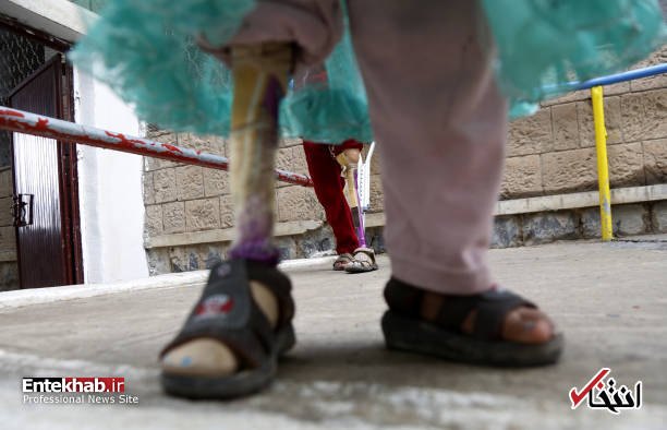 عکس/ راه رفتن کودکان یمنی با پای مصنوعی