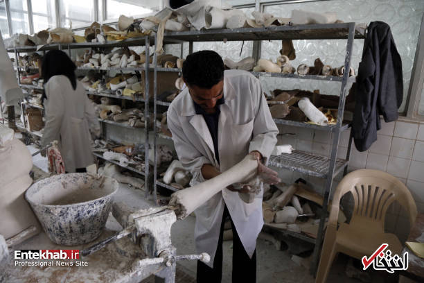 عکس/ راه رفتن کودکان یمنی با پای مصنوعی