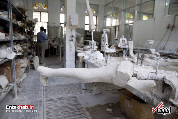 عکس/ راه رفتن کودکان یمنی با پای مصنوعی