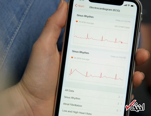 ساعت اپل به روزرسانی شد / شناسایی سریع بیماریهای قلبی