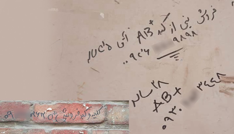 بازار خرید و فروش اعضای بدن؛ کلیه ۱۵۰، نیمی از کبد ۲۰۰ میلیون تومان! / قلب کم است اما هست! بازار خرید و فروش اعضای بدن؛ کلیه ۱۵۰، نیمی از کبد ۲۰۰ میلیون تومان! / قلب کم است اما هست!