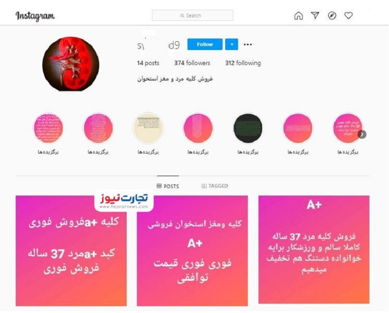 بازار خرید و فروش اعضای بدن؛ کلیه ۱۵۰، نیمی از کبد ۲۰۰ میلیون تومان! / قلب کم است اما هست! بازار خرید و فروش اعضای بدن؛ کلیه ۱۵۰، نیمی از کبد ۲۰۰ میلیون تومان! / قلب کم است اما هست!