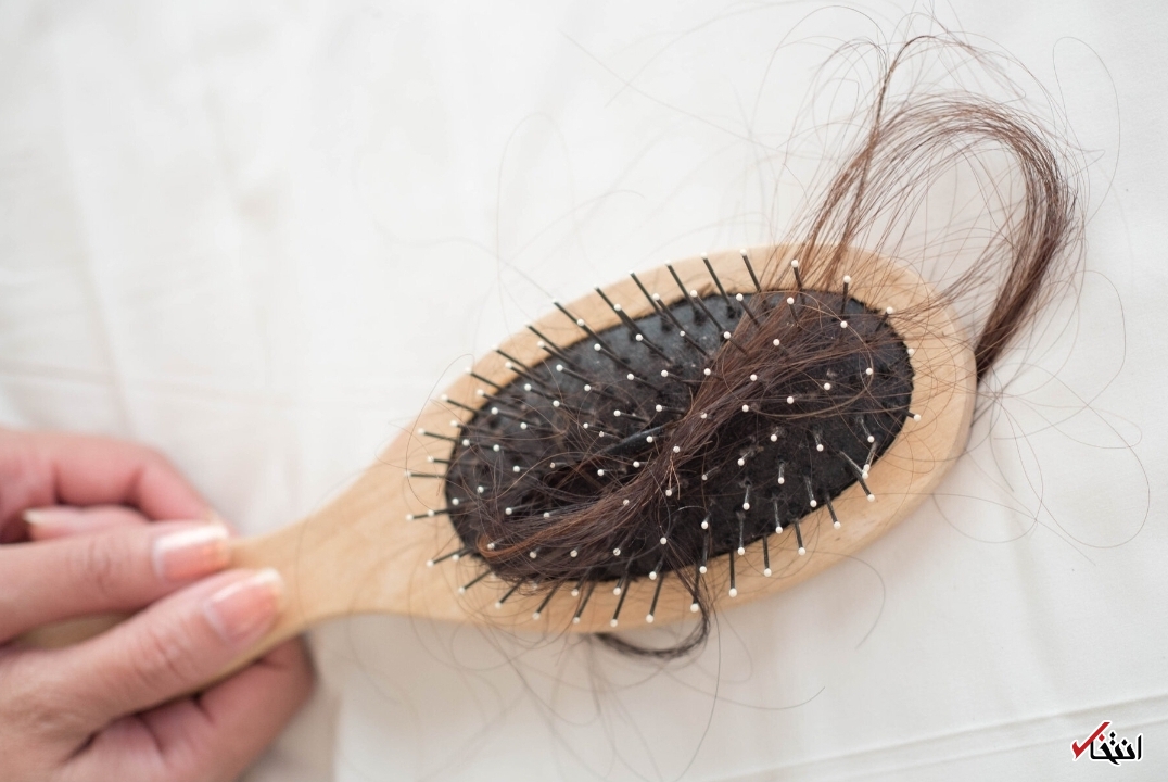 کابوسی به نام ریزش مو/از علل تا راهکار‌های درمان