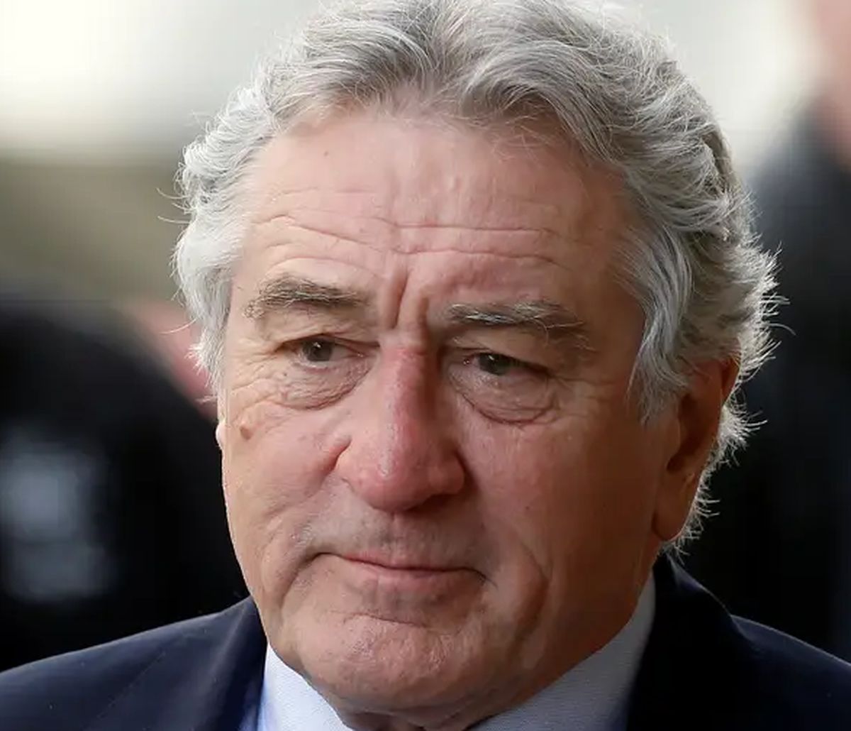 کدام بازیگران مشهور جراحی زیبایی بینی یا رینوپلاستی انجام داده اند؟