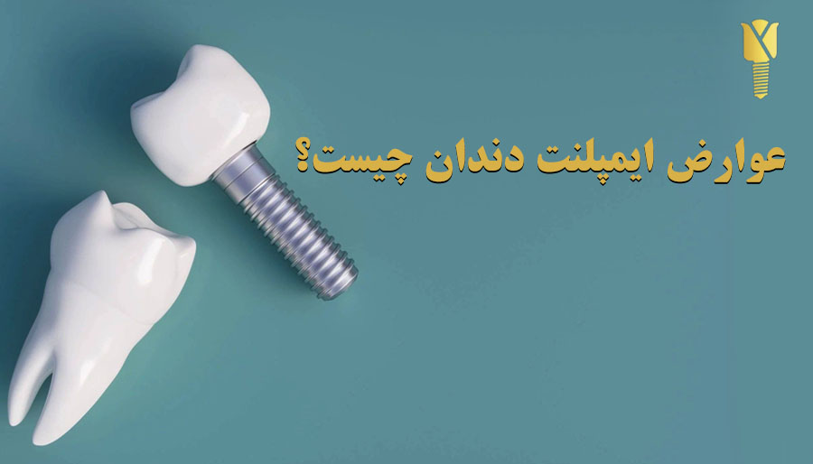 عوارض ایمپلنت دندان و روش های پیشگیری عوارض ایمپلنت دندان و روش های پیشگیری