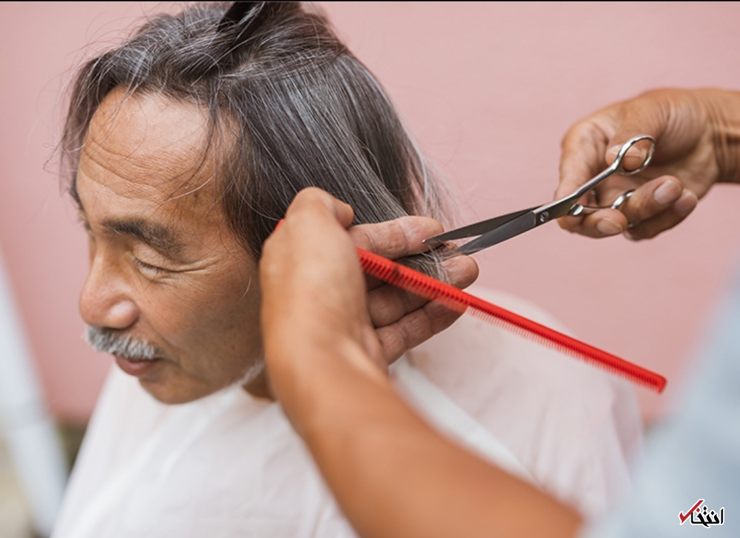 دلایل شگفت آور ریزش موی شما (قسمت سوم)