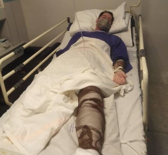 ناظر گمرکات هرمزگان: معاون گمرک شهید رجایی مورد سوءقصد قرار گرفت / او مجروح شده و در بیمارستان بستری است / ساعاتی قبل مورد عمل جراحی قرار گرفت