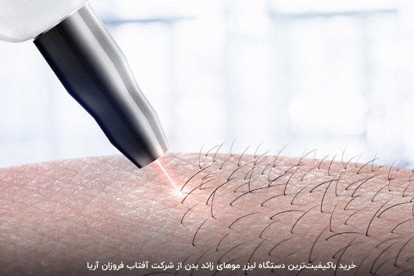 لیزر موهای زائد با کدام دستگاه بهتر است