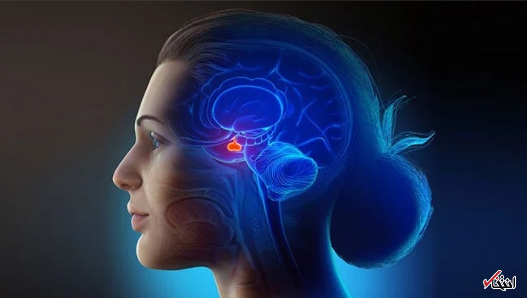 علائم پرولاکتینوما 