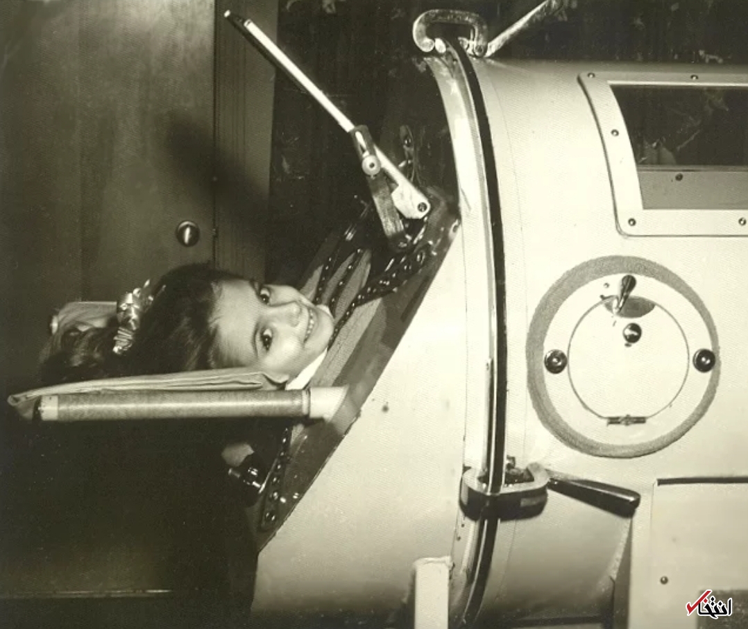 تجربه عجیب ۶۸ سال زندگی با ریه آهنی+تصاویر