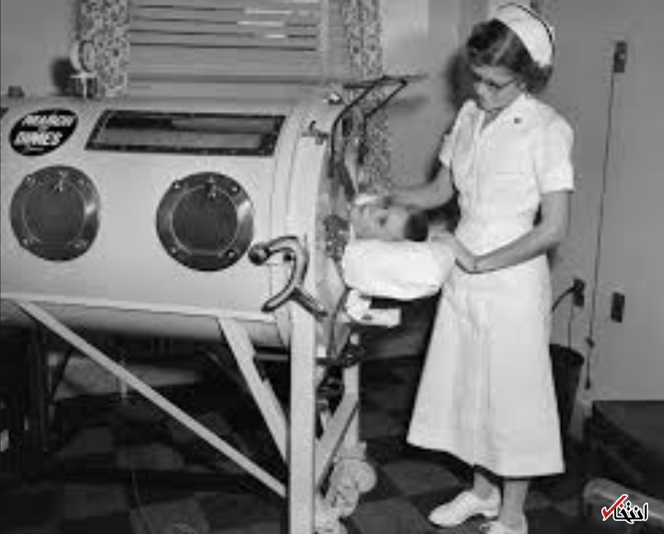 تجربه عجیب ۶۸ سال زندگی با ریه آهنی+تصاویر