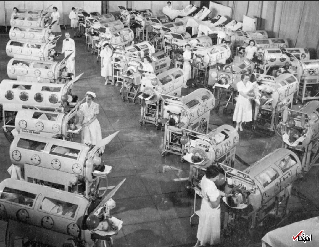 تجربه عجیب ۶۸ سال زندگی با ریه آهنی+تصاویر