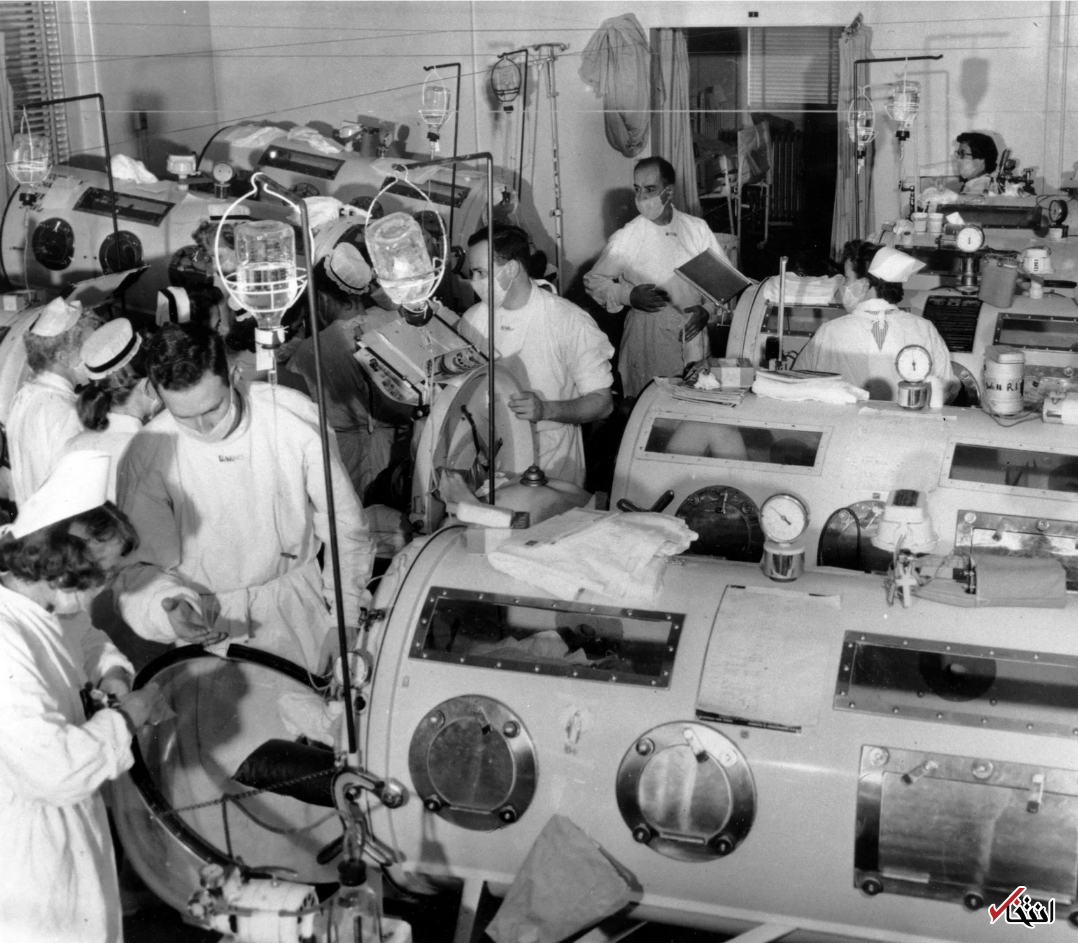 تجربه عجیب ۶۸ سال زندگی با ریه آهنی+تصاویر