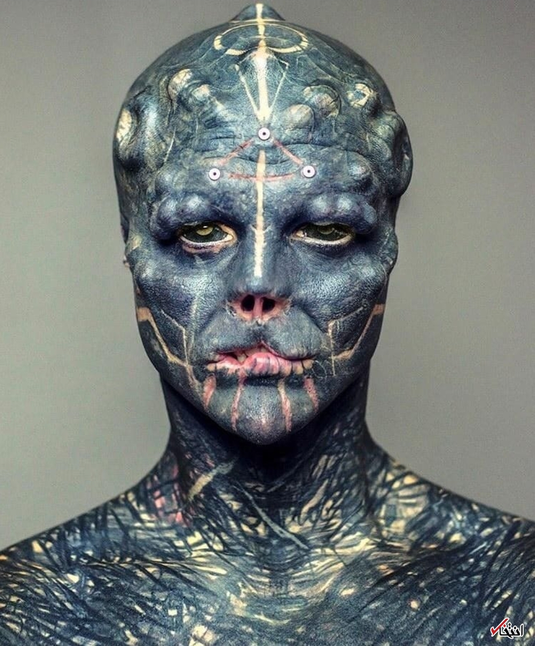 عجیب‌ترین جراحی زیبایی جهان/قطع انگشتان دست برای ایجاد پنجه! +تصاویر