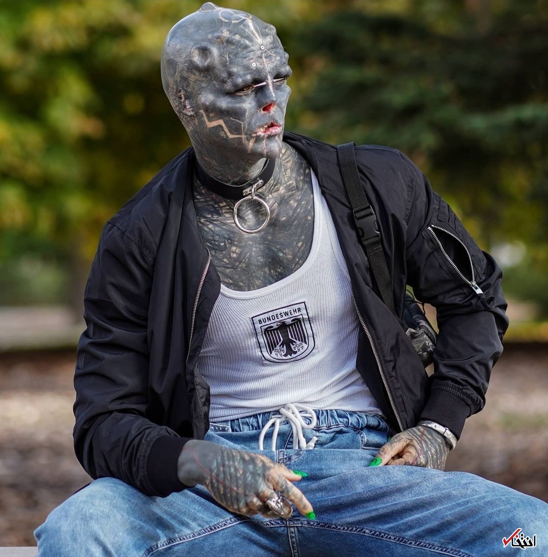 عجیب‌ترین جراحی زیبایی جهان/قطع انگشتان دست برای ایجاد پنجه! +تصاویر