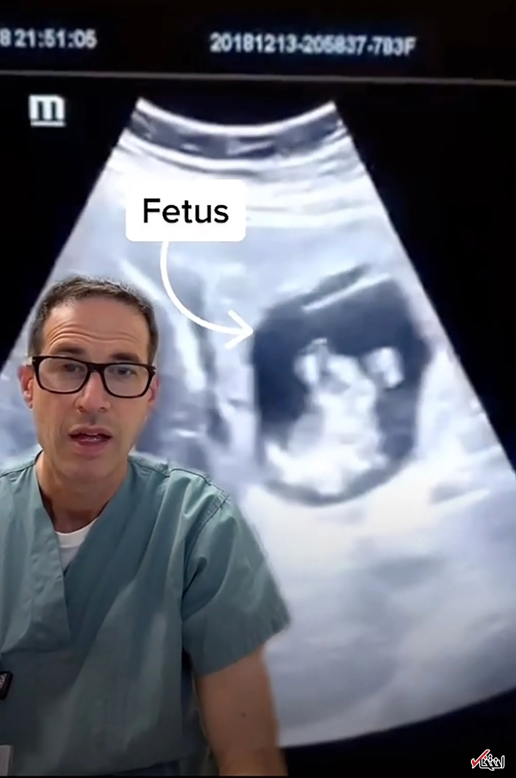 شوکه شدن پزشکان از  رشد جنین در کبد مادر