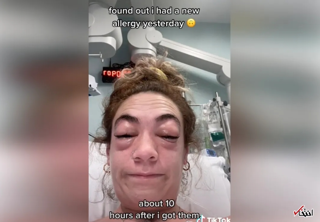 عاقبت وحشتناک اکستنشن مژه+تصاویر