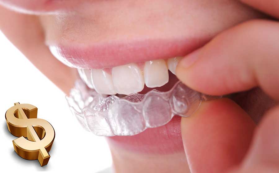 3 دلیل که چرا هزینه ارتودنسی نامرئی با پلاک شفاف بسیار متغیر است 3 دلیل که چرا هزینه ارتودنسی نامرئی با پلاک شفاف بسیار متغیر است