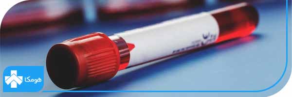  در آزمایش خون چیست