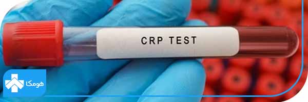  در آزمایش خون چیست