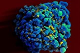 ویروس HIV فرایند پیری بدن را تسریع می کند